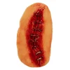 Metal Suture Appliance